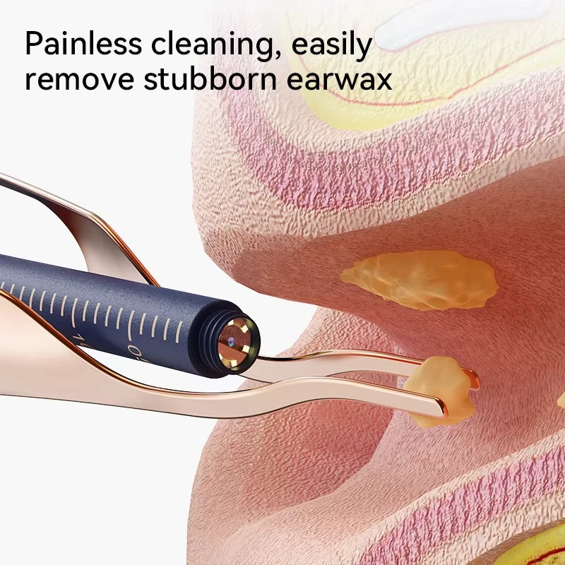 Ear Wax Cleaner With Camera