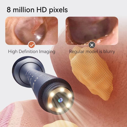 Ear Wax Cleaner With Camera